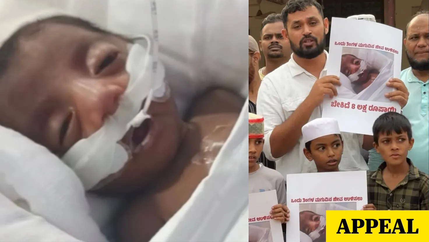 ಕಣ್ಣು ತೆರೆಯುವ ಮುನ್ನವೇ ತಾಯಿ ಅಗಲಿಕೆ: ಮಣಿಪಾಲ್ ಆಸ್ಪತ್ರೆಯಲ್ಲಿ ಸಾವು ಬದುಕಿನ ನಡುವೆ ಹೋರಾಡುತ್ತಿರುವ ಕಂದಮ್ಮನ ಜೀವ ಉಳಿಸಲು ದಾನಿಗಳ ಸಹಾಯಕ್ಕೆ ಮನವಿ